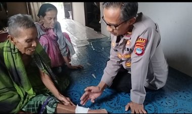 Teror Monyet Liar Resahkan Warga Aluh-Aluh, Sembilan Orang Jadi Korban Serangan